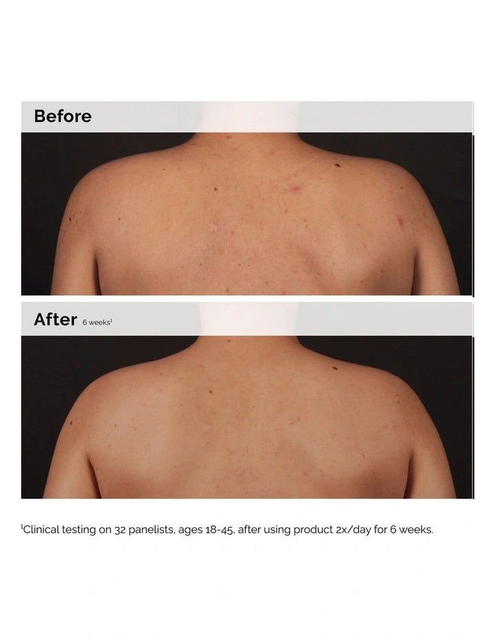 The Ordinary Salicylic Acid 0.5% Body Serum 240ml