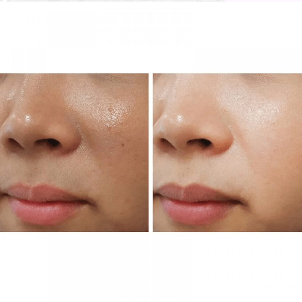 ACM Depiwhite Cream For Brown Spot 40ml