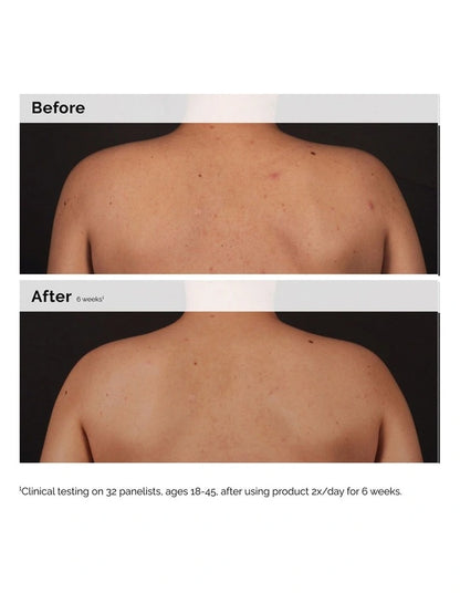 The Ordinary Salicylic Acid 0.5% Body Serum 240ml