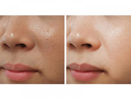 ACM Depiwhite Cream For Brown Spot 40ml