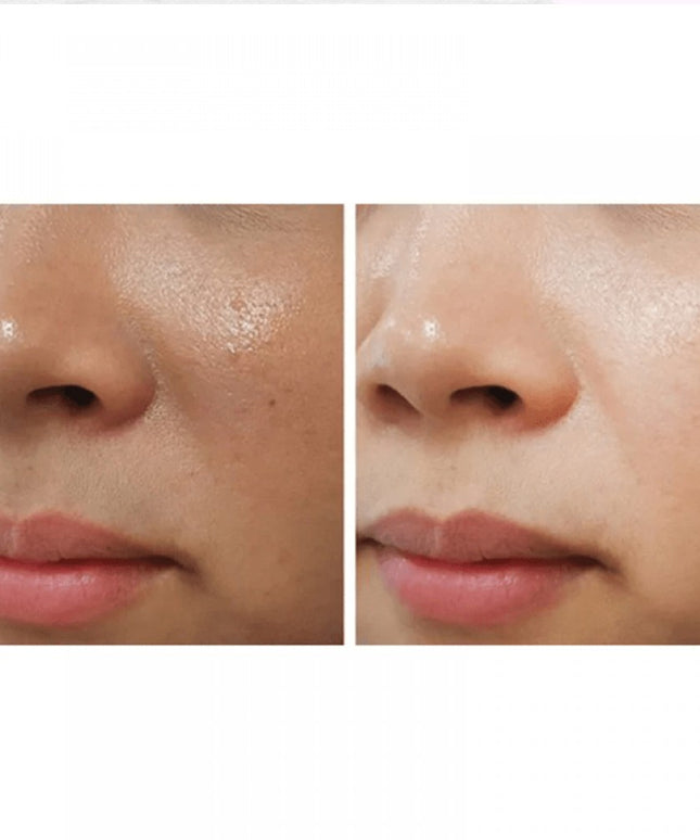 ACM Depiwhite Cream For Brown Spot 40ml