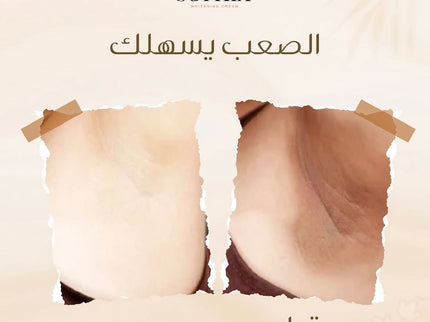 Sophia Whitening Cream