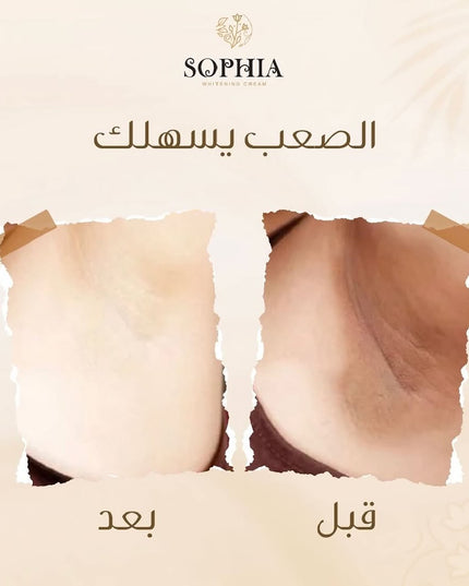 Sophia Whitening Cream