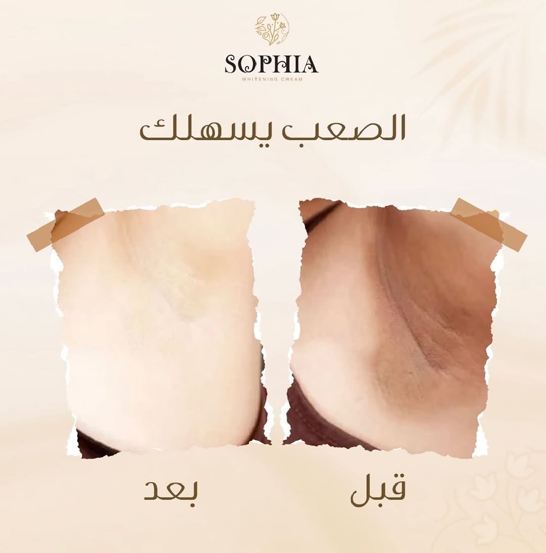 Sophia Whitening Cream