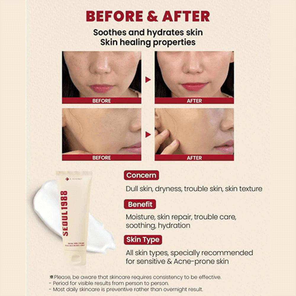 K-Secret Seoul 1988 Snail Mucin 93% + Rice Extract Cream 100ml