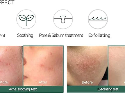 Some By Mi Aha Bha Pha 30Days Miracle Acne Clear Foam 100Ml