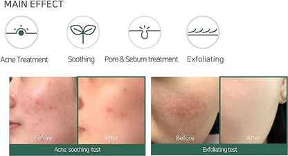 Some By Mi Aha Bha Pha 30Days Miracle Acne Clear Foam 100Ml