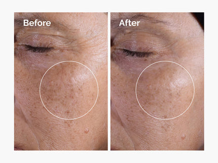 The Ordinary Glycolic Acid 7% Exfoliating Toner