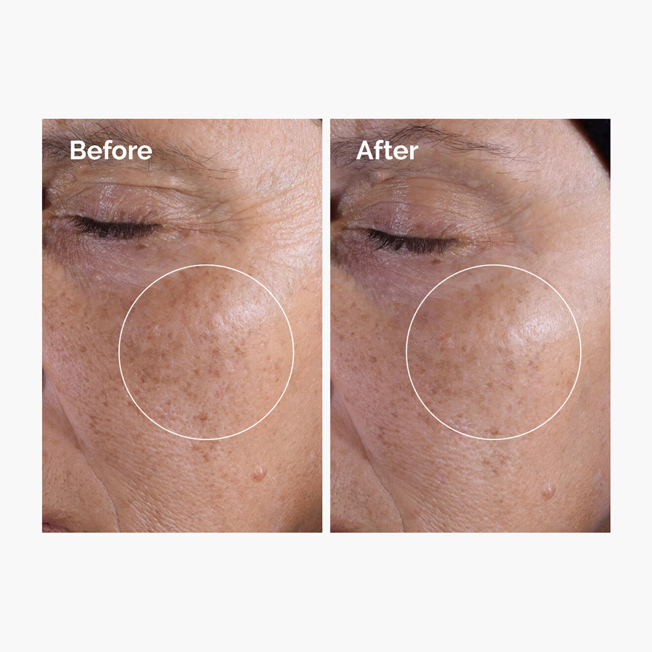 The Ordinary Glycolic Acid 7% Exfoliating Toner