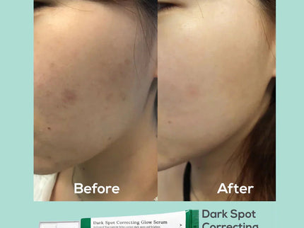 Axis-Y Dark Spot Correcting Brighten + Moisturize Glow Facial Serum 50ml