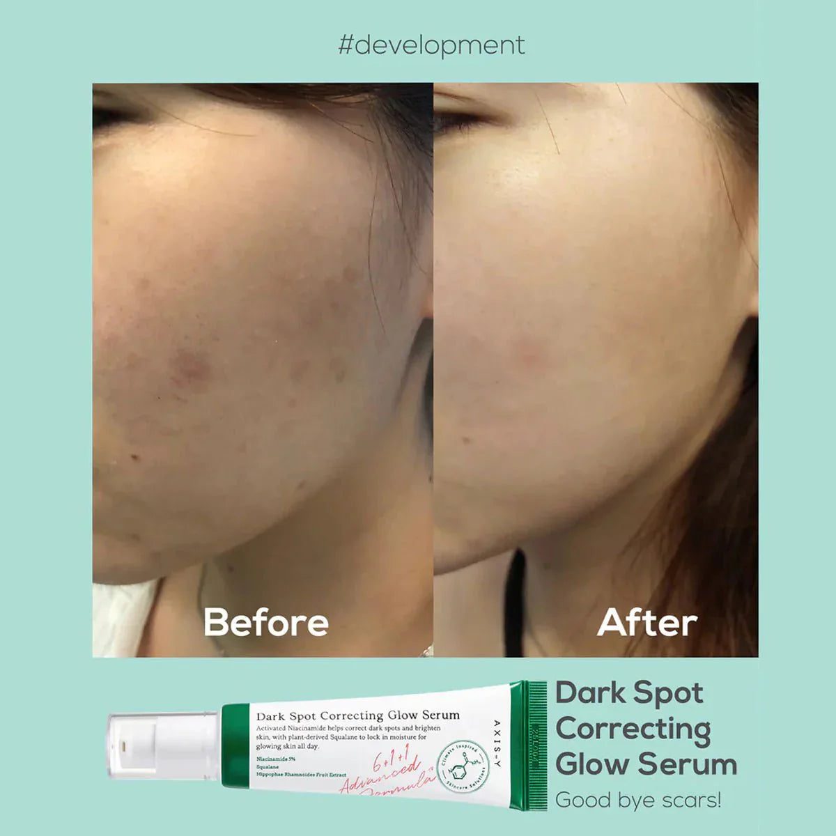 Axis-Y Dark Spot Correcting Brighten + Moisturize Glow Facial Serum 50ml