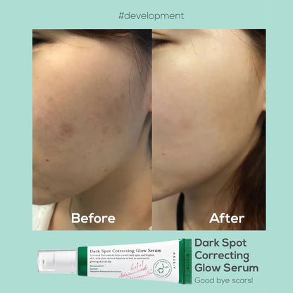 Axis-Y Dark Spot Correcting Brighten + Moisturize Glow Facial Serum 50ml