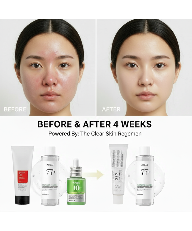 Acne Treatment Set – Clear, Calm & Healthy Skin Routine