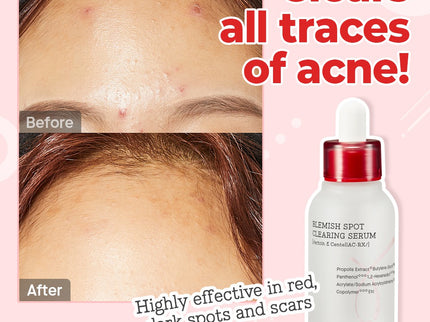 Cosrx AC Collection Blemish Spot Clearing Serum 40ml