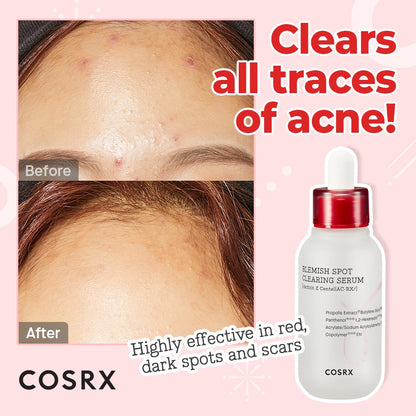 Cosrx AC Collection Blemish Spot Clearing Serum 40ml