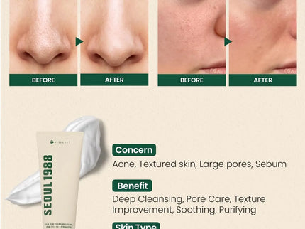 K-Secret Seoul 1988 Pine Cica 1% + Probiotics Cleansing Foam 150ml