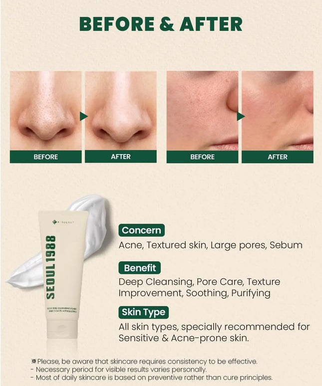 K-Secret Seoul 1988 Pine Cica 1% + Probiotics Cleansing Foam 150ml