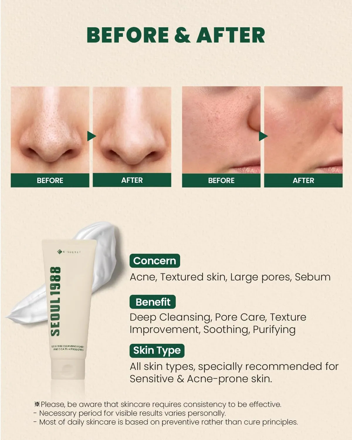 K-Secret Seoul 1988 Pine Cica 1% + Probiotics Cleansing Foam 150ml
