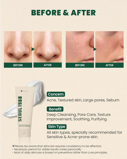 K-Secret Seoul 1988 Pine Cica 1% + Probiotics Cleansing Foam 150ml