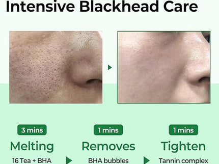 Some by Mi Bye Bye Blackhead Green Tea Tox Bubble Cleanser - 120 gms